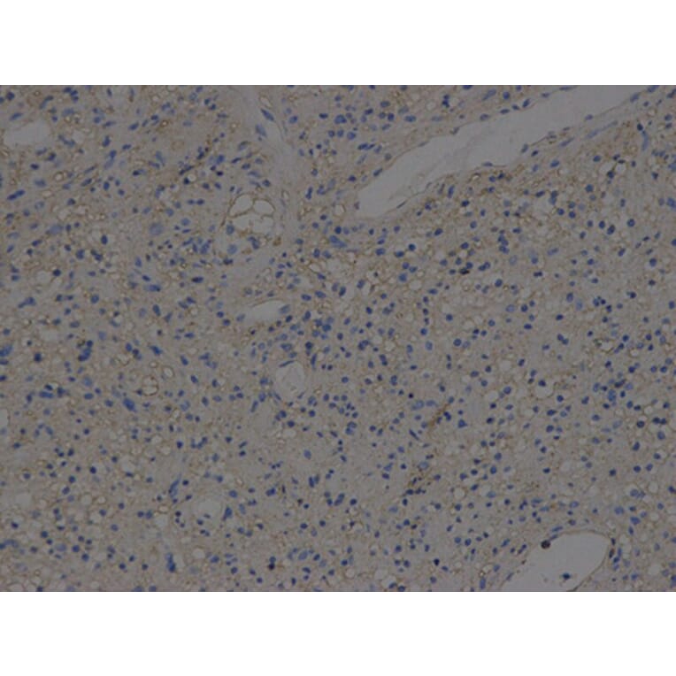Immunohistochemistry - HLA-A Antibody from Signalway Antibody (32636) - Antibodies.com
