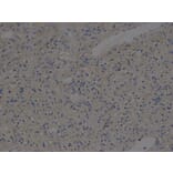 Immunohistochemistry - HLA-A Antibody from Signalway Antibody (32636) - Antibodies.com