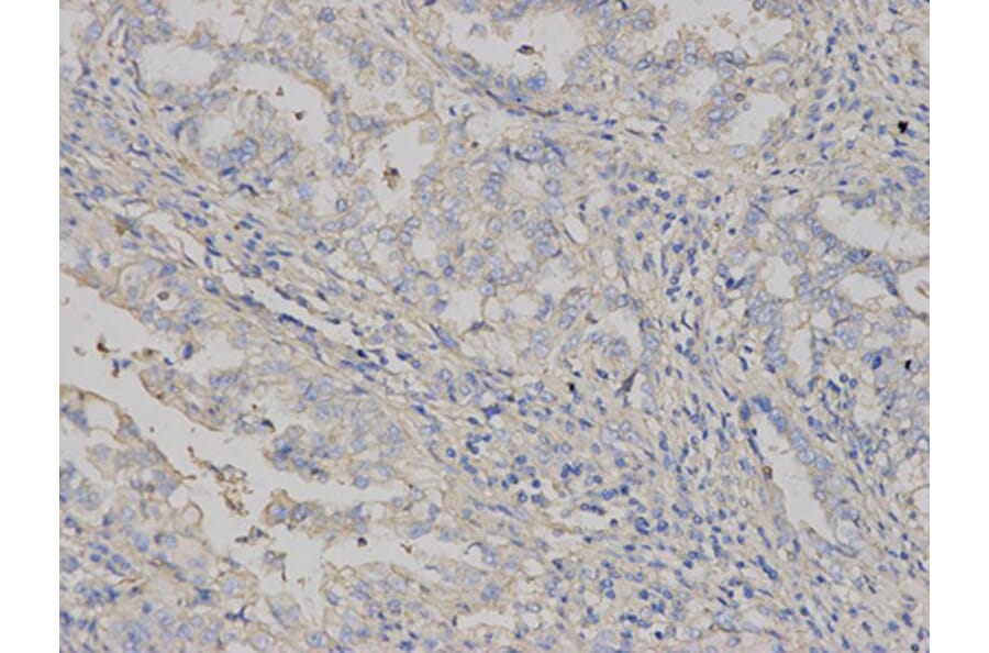 Immunohistochemistry - HLA-A Antibody from Signalway Antibody (32636) - Antibodies.com