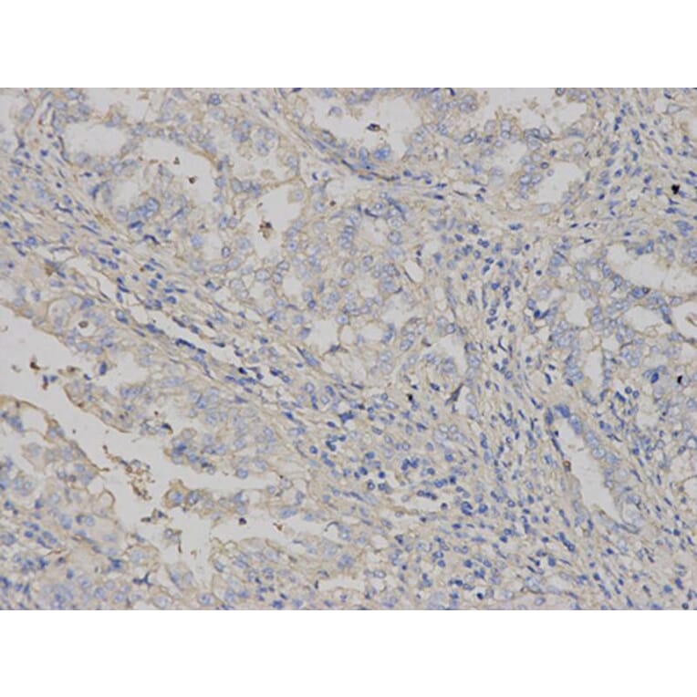 Immunohistochemistry - HLA-A Antibody from Signalway Antibody (32636) - Antibodies.com