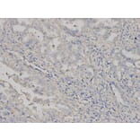 Immunohistochemistry - HLA-A Antibody from Signalway Antibody (32636) - Antibodies.com