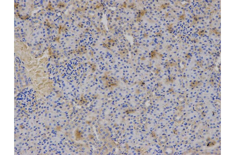 Immunohistochemistry - HLA-A Antibody from Signalway Antibody (32636) - Antibodies.com