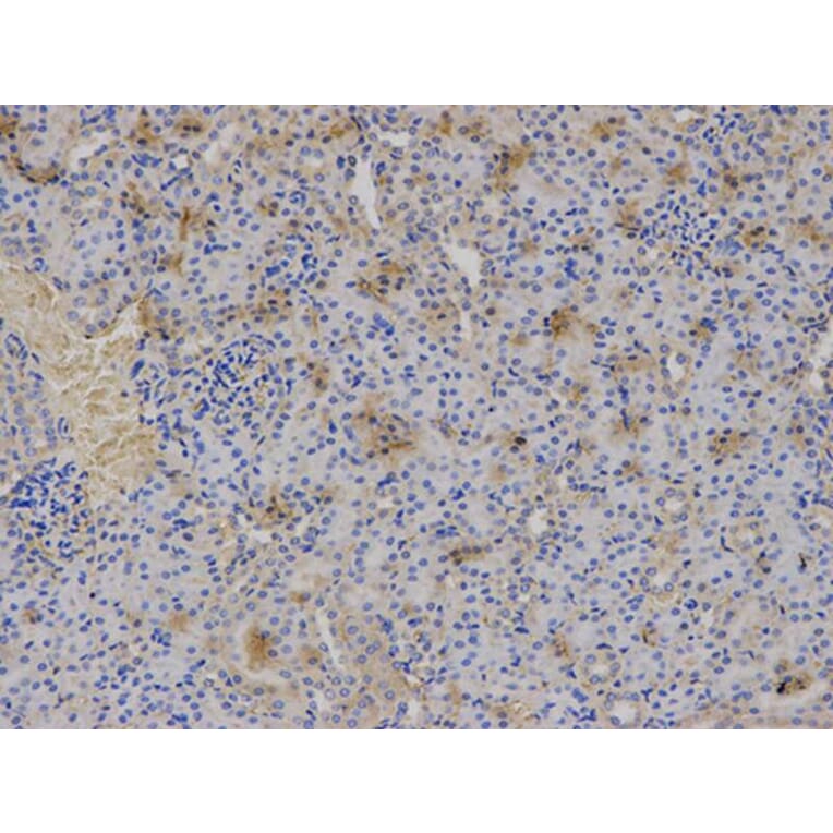 Immunohistochemistry - HLA-A Antibody from Signalway Antibody (32636) - Antibodies.com