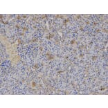 Immunohistochemistry - HLA-A Antibody from Signalway Antibody (32636) - Antibodies.com