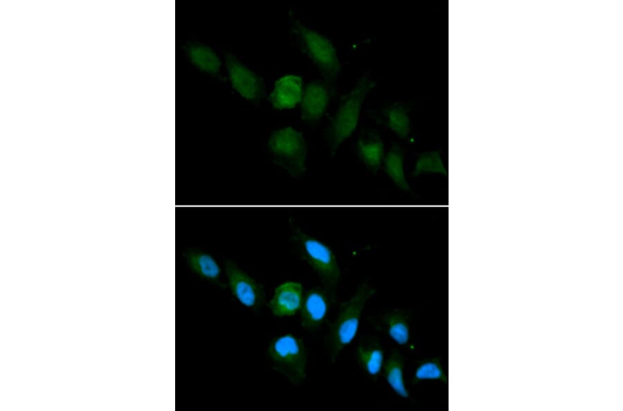 Immunofluorescence - HLA-A Antibody from Signalway Antibody (32636) - Antibodies.com