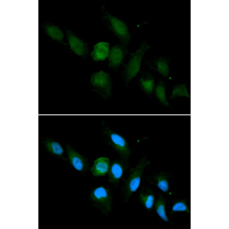 Immunofluorescence - HLA-A Antibody from Signalway Antibody (32636) - Antibodies.com
