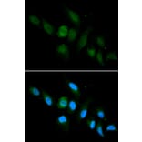 Immunofluorescence - HLA-A Antibody from Signalway Antibody (32636) - Antibodies.com