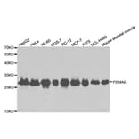 Western blot - PSMA6 Antibody from Signalway Antibody (32652) - Antibodies.com
