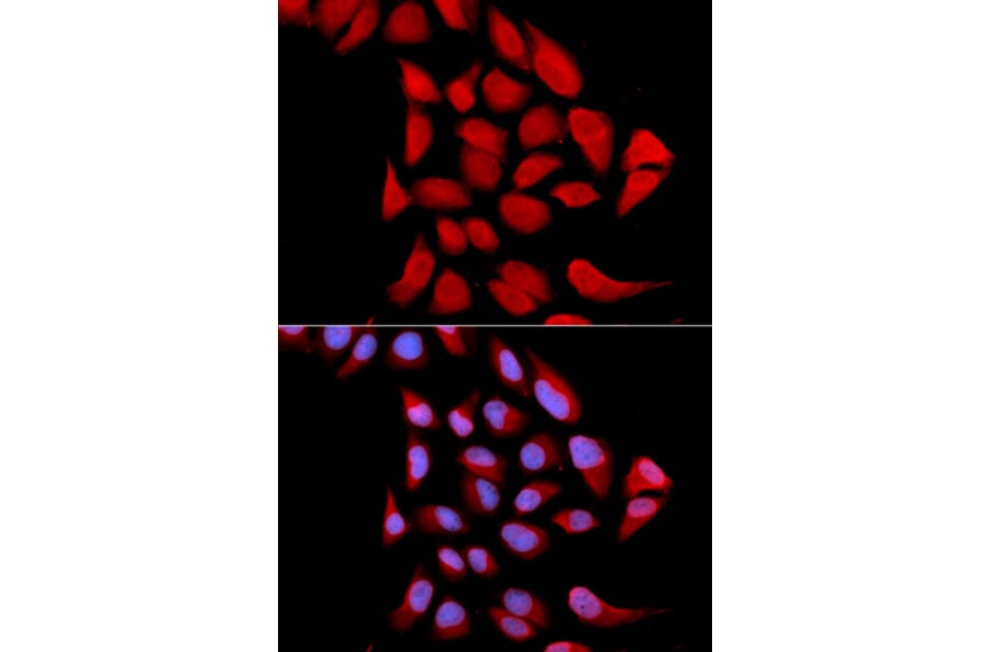 Immunofluorescence - PSMA6 Antibody from Signalway Antibody (32652) - Antibodies.com