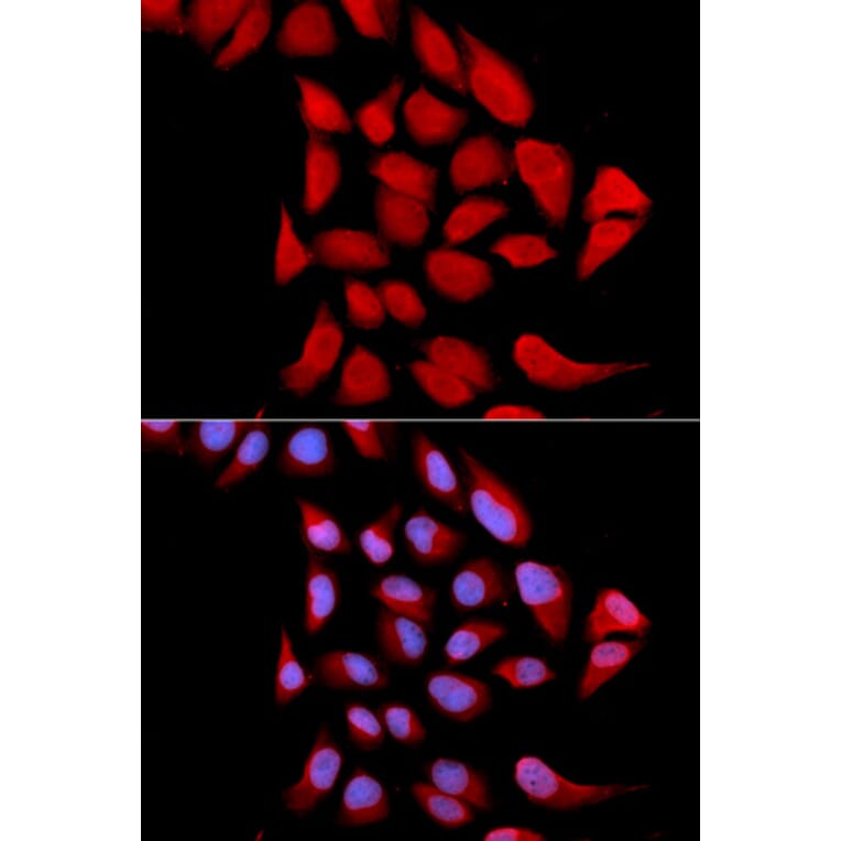 Immunofluorescence - PSMA6 Antibody from Signalway Antibody (32652) - Antibodies.com