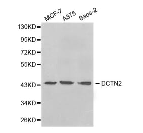 Western blot - DCTN2 Antibody from Signalway Antibody (32662) - Antibodies.com
