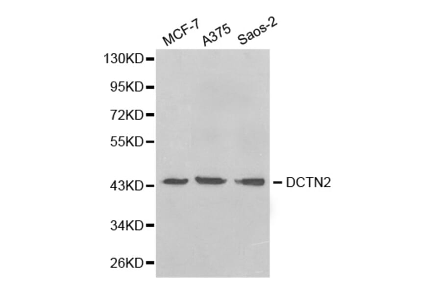 Western blot - DCTN2 Antibody from Signalway Antibody (32662) - Antibodies.com