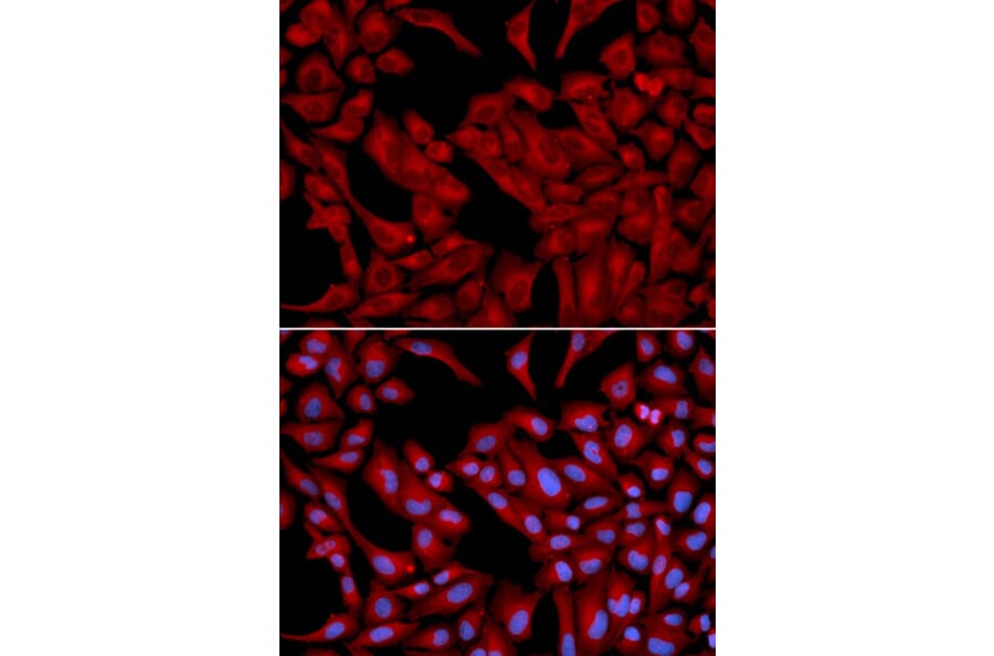 Immunofluorescence - DCTN2 Antibody from Signalway Antibody (32662) - Antibodies.com