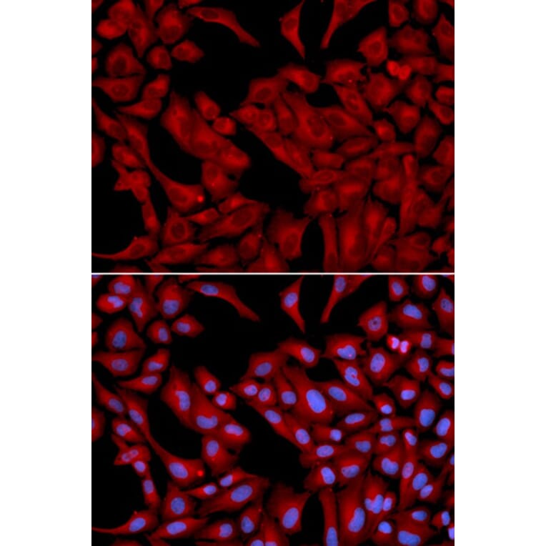 Immunofluorescence - DCTN2 Antibody from Signalway Antibody (32662) - Antibodies.com