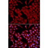 Immunofluorescence - DCTN2 Antibody from Signalway Antibody (32662) - Antibodies.com