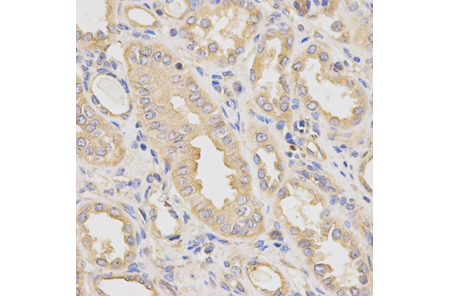 Immunohistochemistry - DCTN2 Antibody from Signalway Antibody (32662) - Antibodies.com