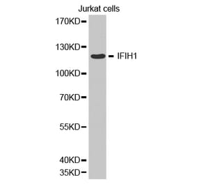 Western blot - IFIH1 Antibody from Signalway Antibody (32665) - Antibodies.com