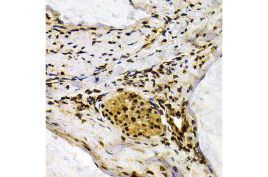 Immunohistochemistry - IFIH1 Antibody from Signalway Antibody (32665) - Antibodies.com