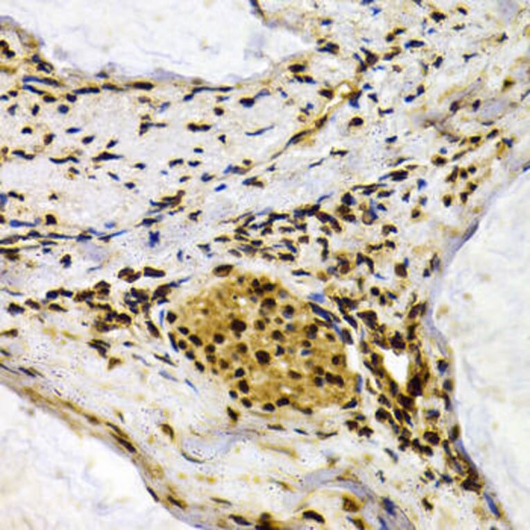 Immunohistochemistry - IFIH1 Antibody from Signalway Antibody (32665) - Antibodies.com
