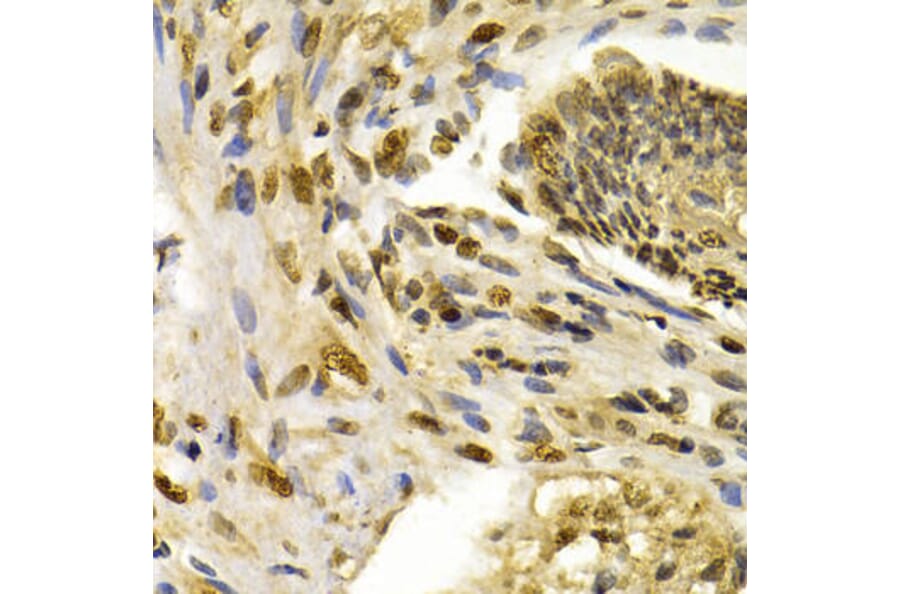 Immunohistochemistry - IFIH1 Antibody from Signalway Antibody (32665) - Antibodies.com
