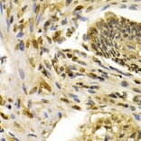 Immunohistochemistry - IFIH1 Antibody from Signalway Antibody (32665) - Antibodies.com