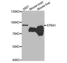 Western blot - EPB41 Antibody from Signalway Antibody (32669) - Antibodies.com