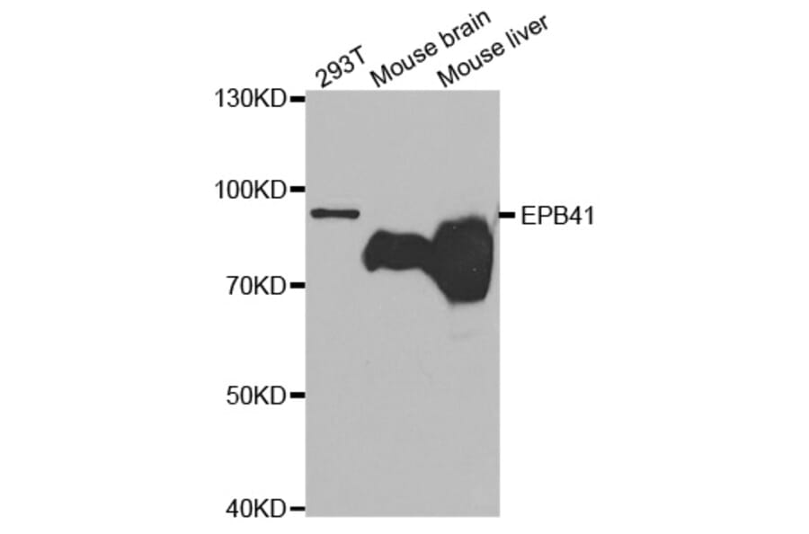 Western blot - EPB41 Antibody from Signalway Antibody (32669) - Antibodies.com