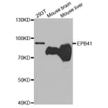 Western blot - EPB41 Antibody from Signalway Antibody (32669) - Antibodies.com