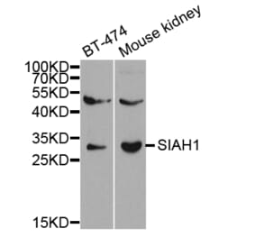Western blot - SIAH1 Antibody from Signalway Antibody (32672) - Antibodies.com