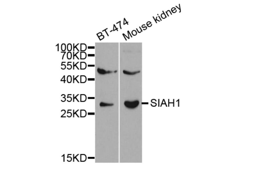 Western blot - SIAH1 Antibody from Signalway Antibody (32672) - Antibodies.com