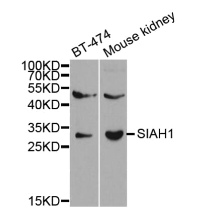 Western blot - SIAH1 Antibody from Signalway Antibody (32672) - Antibodies.com
