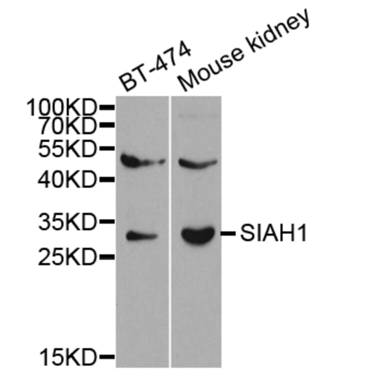 Western blot - SIAH1 Antibody from Signalway Antibody (32672) - Antibodies.com