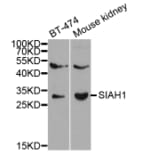 Western blot - SIAH1 Antibody from Signalway Antibody (32672) - Antibodies.com