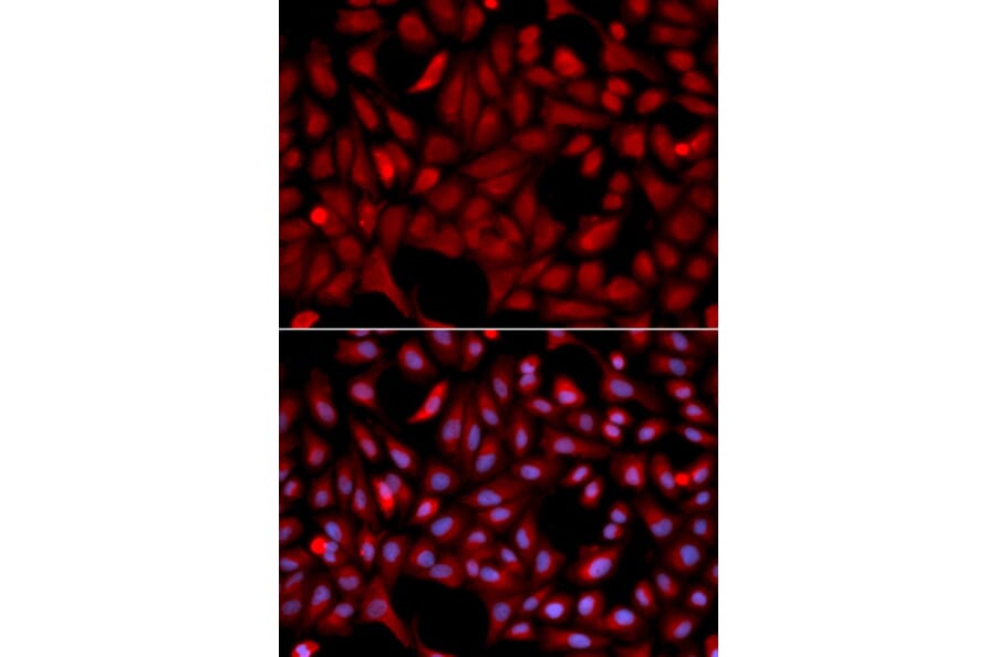 Immunofluorescence - SIAH1 Antibody from Signalway Antibody (32672) - Antibodies.com