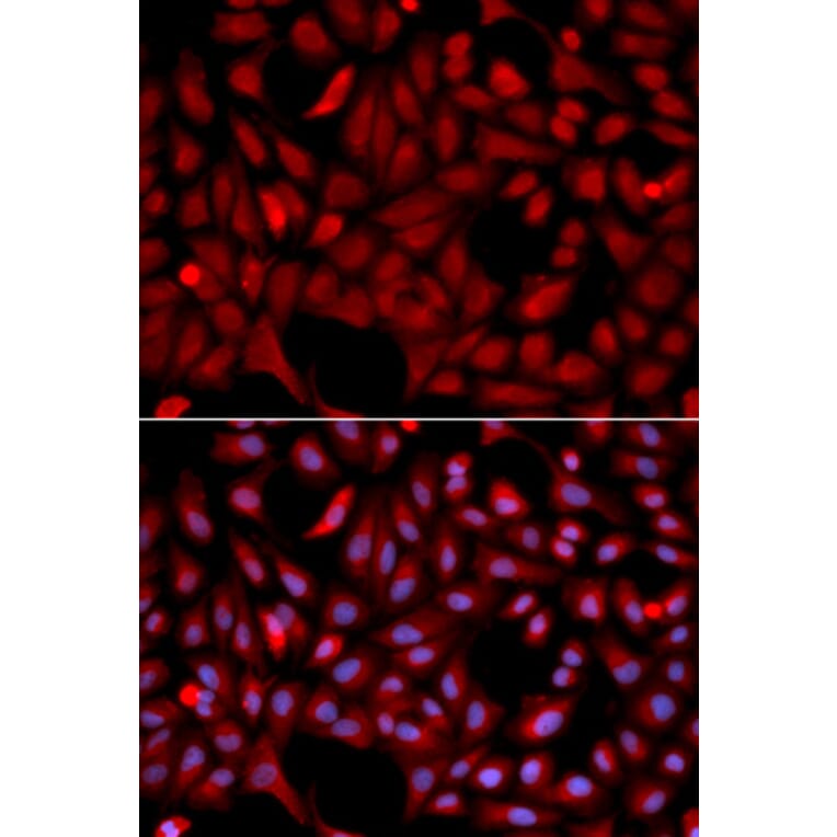 Immunofluorescence - SIAH1 Antibody from Signalway Antibody (32672) - Antibodies.com