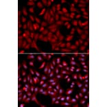 Immunofluorescence - SIAH1 Antibody from Signalway Antibody (32672) - Antibodies.com