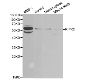Western blot - RIPK2 Antibody from Signalway Antibody (32675) - Antibodies.com