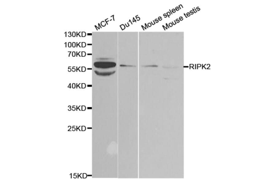 Western blot - RIPK2 Antibody from Signalway Antibody (32675) - Antibodies.com