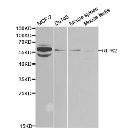 Western blot - RIPK2 Antibody from Signalway Antibody (32675) - Antibodies.com