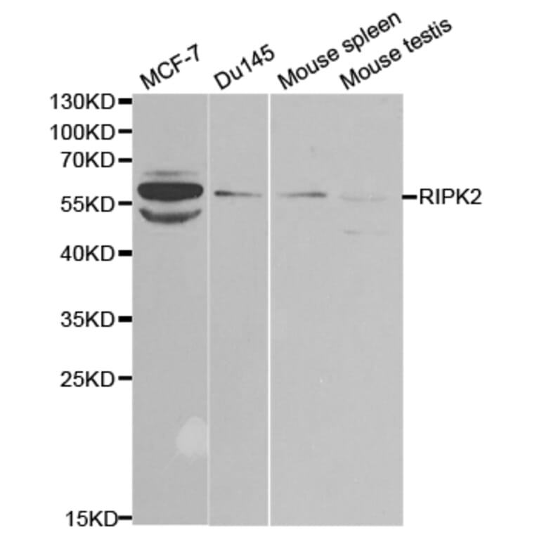 Western blot - RIPK2 Antibody from Signalway Antibody (32675) - Antibodies.com