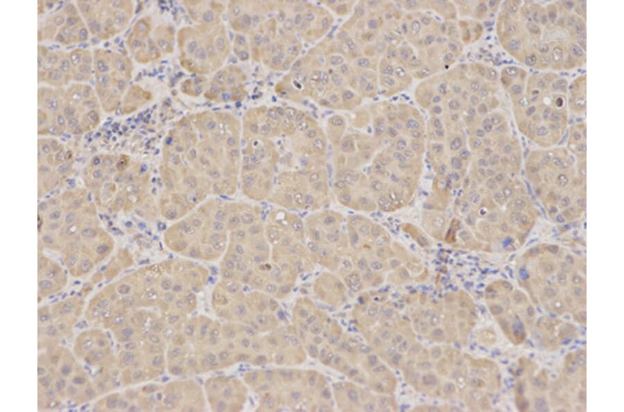 Immunohistochemistry - RIPK2 Antibody from Signalway Antibody (32675) - Antibodies.com