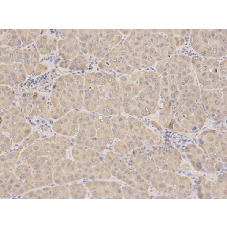 Immunohistochemistry - RIPK2 Antibody from Signalway Antibody (32675) - Antibodies.com