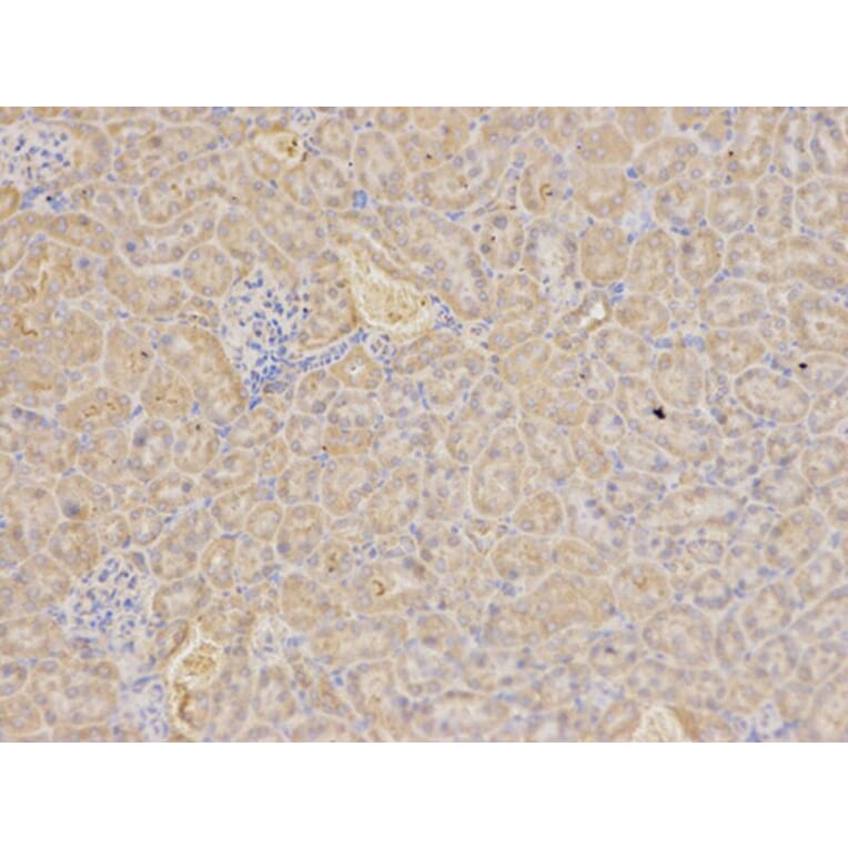 Immunohistochemistry - RIPK2 Antibody from Signalway Antibody (32675) - Antibodies.com