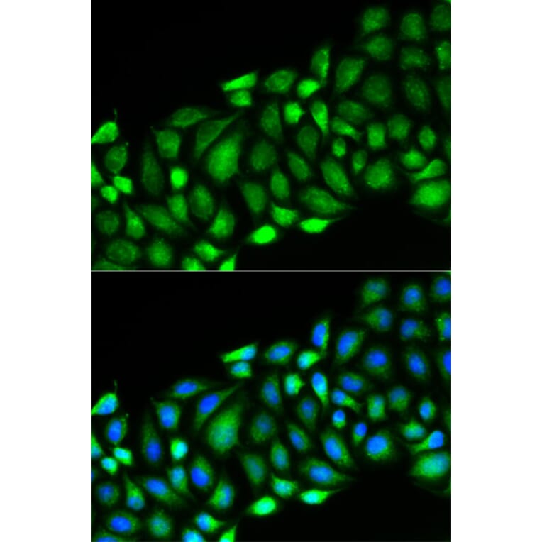 Immunofluorescence - RIPK2 Antibody from Signalway Antibody (32675) - Antibodies.com