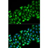 Immunofluorescence - RIPK2 Antibody from Signalway Antibody (32675) - Antibodies.com