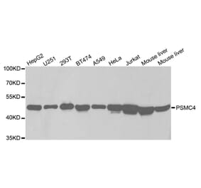 Western blot - PSMC4 Antibody from Signalway Antibody (32681) - Antibodies.com