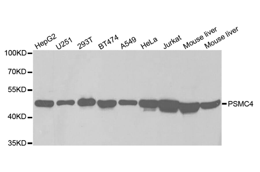 Western blot - PSMC4 Antibody from Signalway Antibody (32681) - Antibodies.com