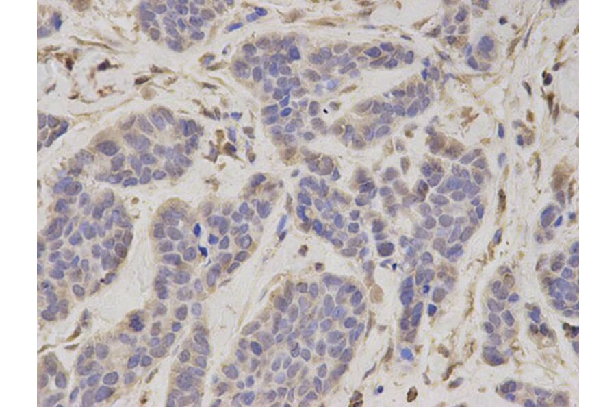 Immunohistochemistry - PSMC4 Antibody from Signalway Antibody (32681) - Antibodies.com