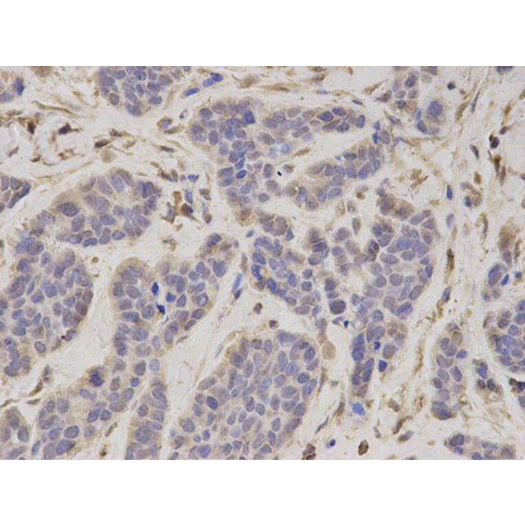 Immunohistochemistry - PSMC4 Antibody from Signalway Antibody (32681) - Antibodies.com