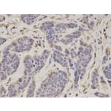 Immunohistochemistry - PSMC4 Antibody from Signalway Antibody (32681) - Antibodies.com